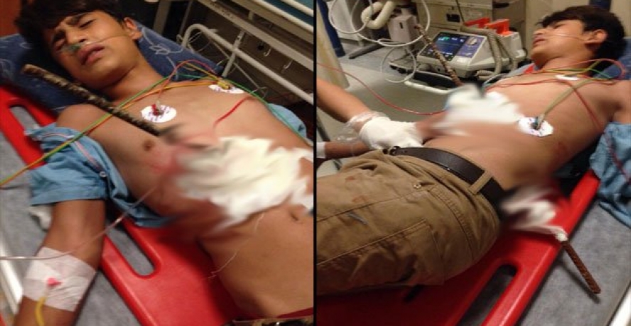 Karnına saplanan demir belinden çıktı