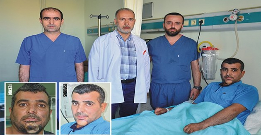 Omuzundan Alınan Doku İle Çene Yapıldı