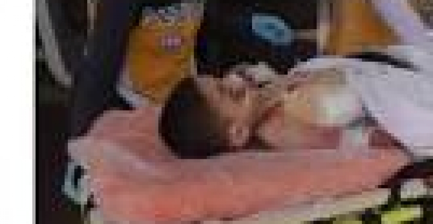 Otomobilin Çarptığı 5 Yaşındaki Çocuk Ağır Yaralandı