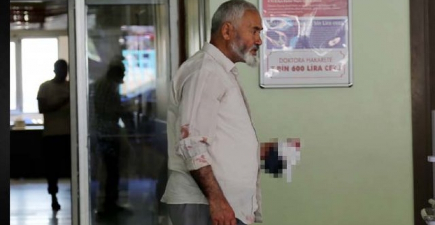 Şanlıurfa’da yaklaşık 100 acemi kasap hastanelik oldu