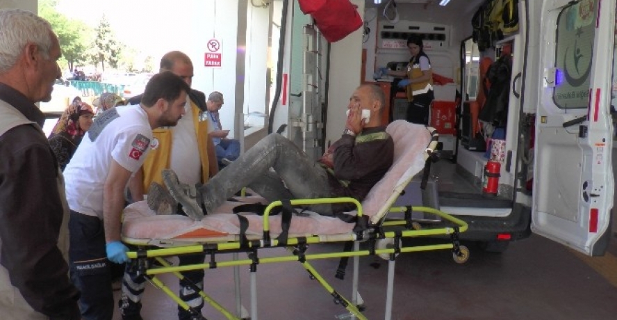 Suriyeli işçi yüzünü kesti